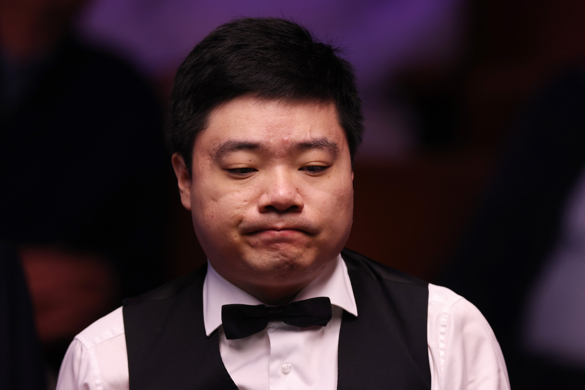 B两套固定 B两套固定